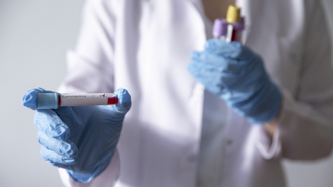 Testování na nákazu koronavirem.