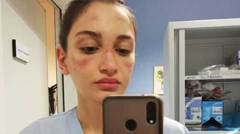 Zdravotníci v Itálii padají vyčerpáním, hodiny se ani nenapijí.