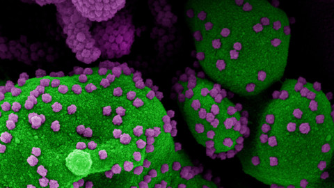 Virus pod mikroskopem.