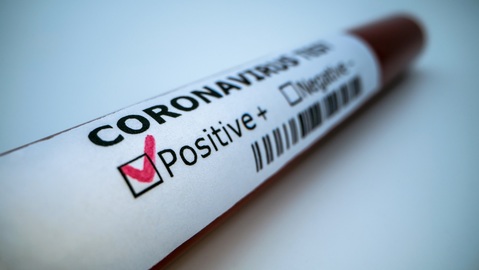 Nárůst počtu nakažených koronavirem ve čtvrtek mírně zpomalil.