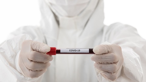 I pozitivní výsledek testu na covid-19 sdělí přímo laboratoře.