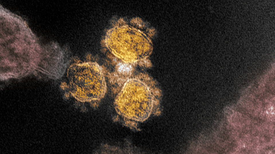 Koronavirus pod drobnohledem.